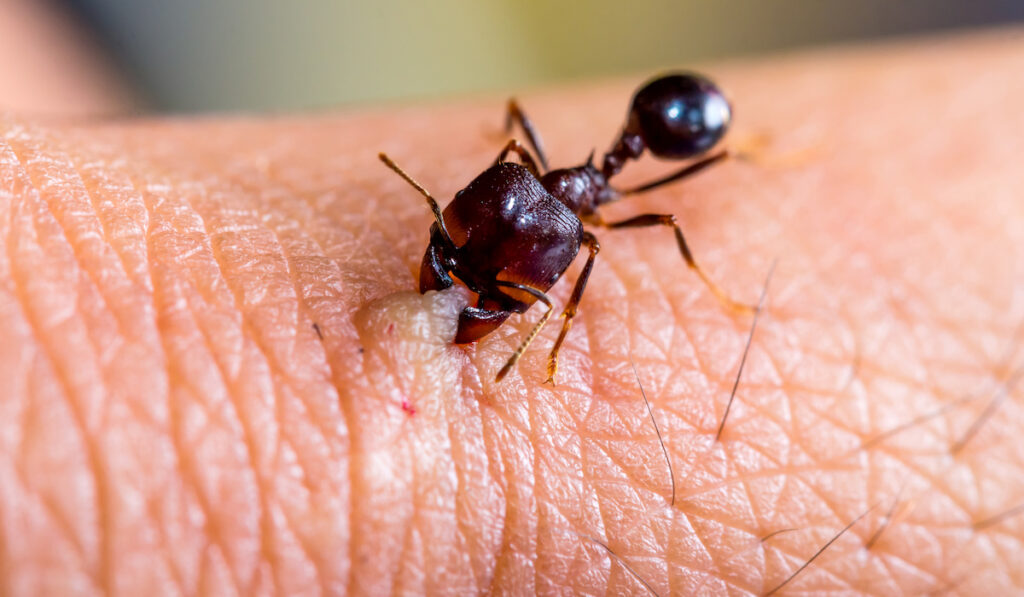 ant biting human skin